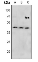 MAP2K4 / MKK4 Antibody - Western blot analysis of MKK4 (pS257) expression in K562 (A), Hela (B), MCF7 (C) whole cell lysates.