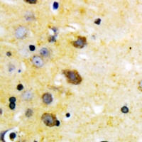 MAP2K4 / MKK4 Antibody - Immunohistochemical analysis of MKK4 (pS257) staining in human brain formalin fixed paraffin embedded tissue section. The section was pre-treated using heat mediated antigen retrieval with sodium citrate buffer (pH 6.0). The section was then incubated with the antibody at room temperature and detected using an HRP conjugated compact polymer system. DAB was used as the chromogen. The section was then counterstained with haematoxylin and mounted with DPX.