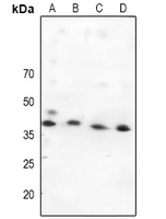 MAP2K4 / MKK4 Antibody - Western blot analysis of MKK4 expression in HEK293T (A), A549 (B), K562 (C), PC3 (D) whole cell lysates.
