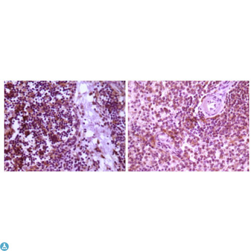MAP2K4 / MKK4 Antibody - Immunohistochemistry (IHC) analysis of paraffin-embedded human thymoma tissue (left) and spleen tissue (right), showing cytoplasmic localization with DAB staining using MEK-4 Monoclonal Antibody.