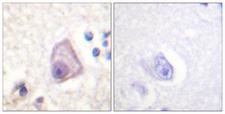 MAP2K4 / MKK4 Antibody - Immunohistochemistry analysis of paraffin-embedded human brain, using SEK1/MKK4/JNKK1 (Phospho-Ser257) Antibody. The picture on the right is blocked with the phospho peptide.