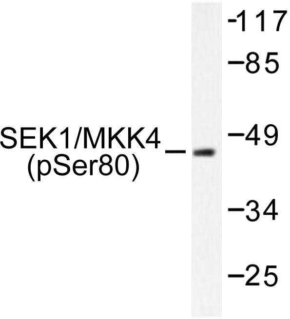 MAP2K4 / MKK4 Antibody - Western blot of p-SEK1/MKK4 (S80) pAb in extracts from NIH/3T3 cells.