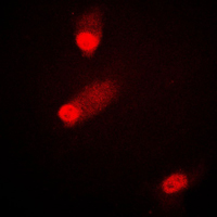 MAP2K4 / MKK4 Antibody - Immunofluorescent analysis of MKK4 (pS80) staining in HEK293T cells. Formalin-fixed cells were permeabilized with 0.1% Triton X-100 in TBS for 5-10 minutes and blocked with 3% BSA-PBS for 30 minutes at room temperature. Cells were probed with the primary antibody in 3% BSA-PBS and incubated overnight at 4 C in a humidified chamber. Cells were washed with PBST and incubated with a DyLight 594-conjugated secondary antibody (red) in PBS at room temperature in the dark. DAPI was used to stain the cell nuclei (blue).