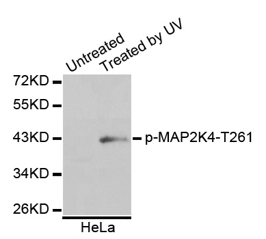 MAP2K4 / MKK4 Antibody - Western blot analysis of extracts of HeLa cells.