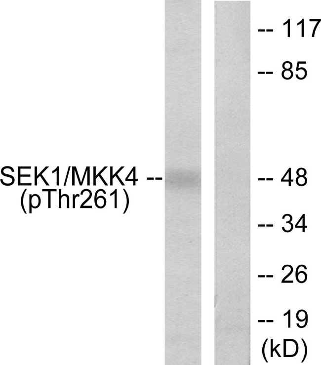 MAP2K4 / MKK4 Antibody - Western blot analysis of lysates from 293 cells treated with UV 15', using SEK1/MKK4 (Phospho-Thr261) Antibody. The lane on the right is blocked with the phospho peptide.