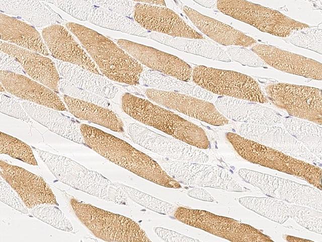 MAP2K4 / MKK4 Antibody - Immunochemical staining of human MAP2K4 in human skeletal muscle with rabbit polyclonal antibody at 1:1000 dilution, formalin-fixed paraffin embedded sections.
