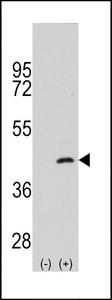 MAP2K4 / MKK4 Antibody - Western blot of MAP2K4 (arrow) using rabbit polyclonal MAP2K4 Antibody (S257). 293 cell lysates (2 ug/lane) either nontransfected (Lane 1) or transiently transfected with the MAP2K4 gene (Lane 2) (Origene Technologies).