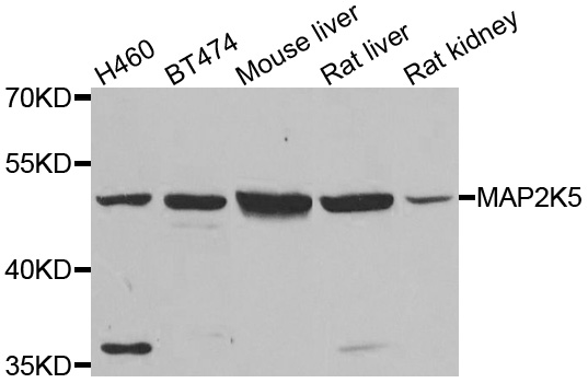 MAP2K5 / MEK5 Antibody - Western blot analysis of extracts of various cell lines.