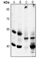 MAP2K5 / MEK5 Antibody - Western blot analysis of MKK5 (pS311) expression in mouse heart (A), rat heart (B), H1792 (C), MCF7 (D) whole cell lysates.