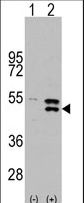 MAP2K5 / MEK5 Antibody - Western blot of MAP2K5 (arrow) using rabbit polyclonal MAP2K5 Antibody (S149). 293 cell lysates (2 ug/lane) either nontransfected (Lane 1) or transiently transfected with the MAP2K5 gene (Lane 2) (Origene Technologies).