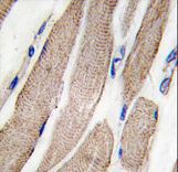 MAP2K5 / MEK5 Antibody - Formalin-fixed and paraffin-embedded human skeletal muscle tissue reacted with MAP2K5 Antibody (S149) , which was peroxidase-conjugated to the secondary antibody, followed by DAB staining. This data demonstrates the use of this antibody for immunohistochemistry; clinical relevance has not been evaluated.