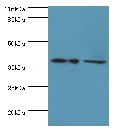 MAP2K6 / MEK6 / MKK6 Antibody - Western blot. All lanes: MAP2K6 antibody at 2 ug/ml. Lane 1: HepG2 whole cell lysate Lane 2: HeLa whole cell lysate. Secondary antibody: goat polyclonal to rabbit at 1:10000 dilution. Predicted band size: 37 kDa. Observed band size: 37 kDa.  This image was taken for the unconjugated form of this product. Other forms have not been tested.