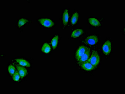 MAP2K6 / MEK6 / MKK6 Antibody - Immunofluorescence staining of A549 cells with MAP2K6 Antibody at 1:200, counter-stained with DAPI. The cells were fixed in 4% formaldehyde, permeabilized using 0.2% Triton X-100 and blocked in 10% normal Goat Serum. The cells were then incubated with the antibody overnight at 4°C. The secondary antibody was Alexa Fluor 488-congugated AffiniPure Goat Anti-Rabbit IgG(H+L).