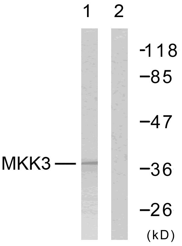 MAP2K6 / MEK6 / MKK6 Antibody - Western blot analysis of lysates from MDA-MB-435 cells, using MKK6 Antibody. The lane on the right is blocked with the synthesized peptide.