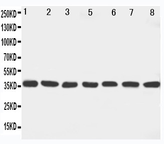 MAP2K6 / MEK6 / MKK6 Antibody - WB of MAP2K6 / MEK6 antibody. Lane 1: Rat Ovary Tissue Lysate. Lane 2: Rat Spleen Tissue Lysate. Lane 3: Rat Brain Tissue Lysate. Lane 4: Rat Heart Tissue Lysate. Lane 5: NIH3I3 Cell Lysate. Lane 6: HELA Cell Lysate. Lane 7: JRUKAT Cell Lysate. Lane 8: MCF-7 Cell Lysate.
