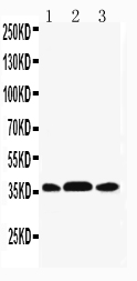 MAP2K6 / MEK6 / MKK6 Antibody - WB of MAP2K6 / MEK6 antibody. Lane 1: NIH3T3 Cell Lysate. Lane 2: HELA Cell Lysate. Lane 3: JRUKAT Cell Lysat.