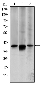 MAP2K6 / MEK6 / MKK6 Antibody - Western blot using MAP2K6 mouse monoclonal antibody against HepG2 (1), MCF-7 (2) and NIH/3T3 (3) cell lysate.