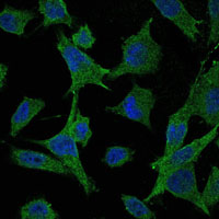 MAP2K6 / MEK6 / MKK6 Antibody - Immunofluorescence of HeLa cells using MAP2K6 mouse monoclonal antibody (green). Blue: DRAQ5 fluorescent DNA dye.