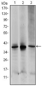 MAP2K6 / MEK6 / MKK6 Antibody - MEK6 Antibody in Western Blot (WB)