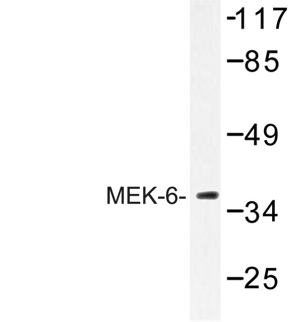 MAP2K6 / MEK6 / MKK6 Antibody - Western blot of MEK-6 (Q3) pAb in extracts from 293 cells.