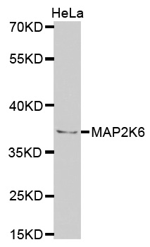 MAP2K6 / MEK6 / MKK6 Antibody - Western blot analysis of extracts of HeLa cells.