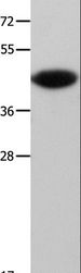 MAP2K6 / MEK6 / MKK6 Antibody - Western blot analysis of Mouse muscle tissue, using MAP2K6 Polyclonal Antibody at dilution of 1:500.