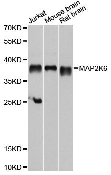MAP2K6 / MEK6 / MKK6 Antibody - Western blot analysis of extracts of various cell lines, using MAP2K6 antibody at 1:1000 dilution. The secondary antibody used was an HRP Goat Anti-Rabbit IgG (H+L) at 1:10000 dilution. Lysates were loaded 25ug per lane and 3% nonfat dry milk in TBST was used for blocking. An ECL Kit was used for detection and the exposure time was 10s.