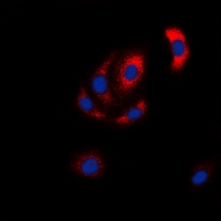 MAP2K6 / MEK6 / MKK6 Antibody - Immunofluorescent analysis of MKK6 staining in HeLa cells. Formalin-fixed cells were permeabilized with 0.1% Triton X-100 in TBS for 5-10 minutes and blocked with 3% BSA-PBS for 30 minutes at room temperature. Cells were probed with the primary antibody in 3% BSA-PBS and incubated overnight at 4 deg C in a humidified chamber. Cells were washed with PBST and incubated with a DyLight 594-conjugated secondary antibody (red) in PBS at room temperature in the dark. DAPI was used to stain the cell nuclei (blue).
