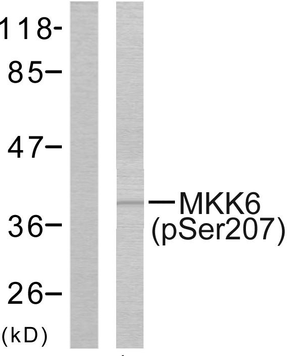 MAP2K6 / MEK6 / MKK6 Antibody - Western blot analysis of lysates from MDA-MB-435 cells, using MKK6 (Phospho-Ser207) Antibody. The lane on the left is blocked with the phospho peptide.