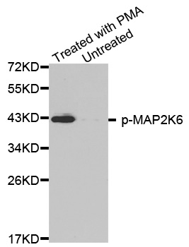 MAP2K6 / MEK6 / MKK6 Antibody - Western blot analysis of extracts from HL60 cells.