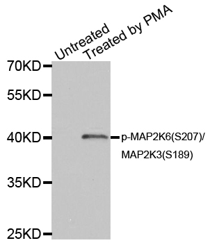 MAP2K6 / MEK6 / MKK6 Antibody - Western blot analysis of extracts of HL60 cell lines.