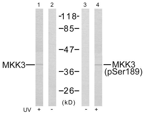 MAP2K6 / MEK6 / MKK6 Antibody - Western blot analysis of the extracts from MDA-MB- 435 cells treated or untreated with UV using MKK3 (Ab-189) Antibody and MKK3 (Phospho- Ser189) Antibody.