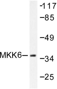MAP2K6 / MEK6 / MKK6 Antibody - Western blot of MKK6 (S201) pAb in extracts from MDA-MB-435 cells.