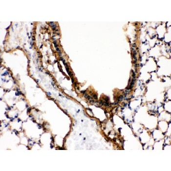 MAP2K7 / MEK7 Antibody - MEK7 antibody IHC-paraffin. IHC(P): Mouse Lung Tissue.