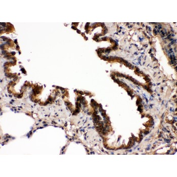 MAP2K7 / MEK7 Antibody - MEK7 antibody IHC-paraffin. IHC(P): Rat Lung Tissue.