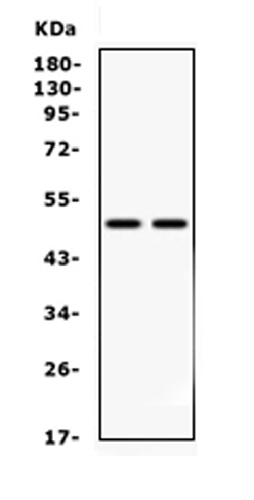 MAP2K7 / MEK7 Antibody - anti-MEK7 Picoband antibody Western blotting All lanes: Anti MEK7 at 0.5ug/ml Lane 1: HELA Whole Cell Lysate at 40ugLane 2: NIH3T3 Whole Cell Lysate at 40ugPredicted bind size: 47KD Observed bind size: 47KD