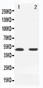 MAP2K7 / MEK7 Antibody - WB of MAP2K7 / MEK7 antibody. Lane 1: Rat Spleen Tissue Lysate. Lane 2: Rat Brain Tissue Lysate.