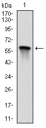 MAP2K7 / MEK7 Antibody - Western blot using MAP2K7 monoclonal antibody against human MAP2K7 (AA: 7-178) recombinant protein. (Expected MW is 45.1 kDa)