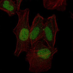 MAP2K7 / MEK7 Antibody - Immunofluorescence of HeLa cells using MAP2K7 mouse monoclonal antibody (green). Red: Actin filaments have been labeled with Alexa Fluor-555 phalloidin.