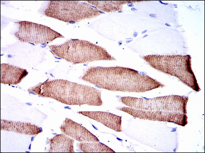 MAP2K7 / MEK7 Antibody - IHC of paraffin-embedded muscle tissues using MAP2K7 mouse monoclonal antibody with DAB staining.