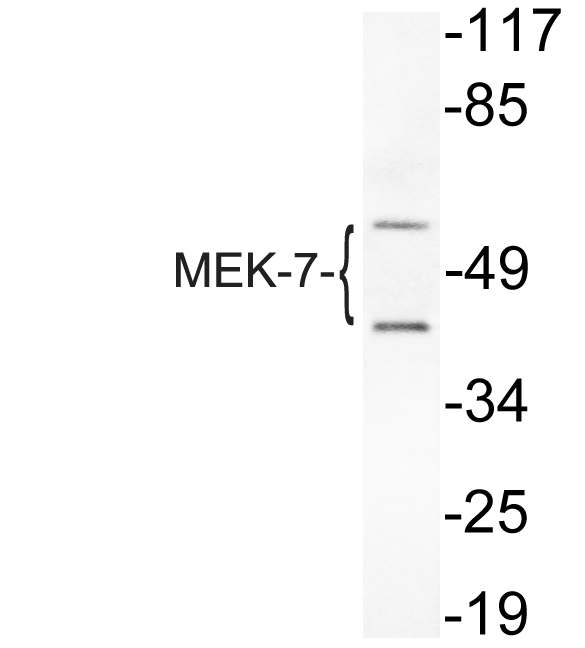 MAP2K7 / MEK7 Antibody - Western blot of MEK-7 (I264) pAb in extracts from HeLa cells.