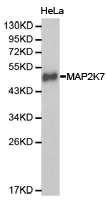 MAP2K7 / MEK7 Antibody - Western blot of extracts of HeLa cell lines, using MKK7/MAP2K7 antibody.