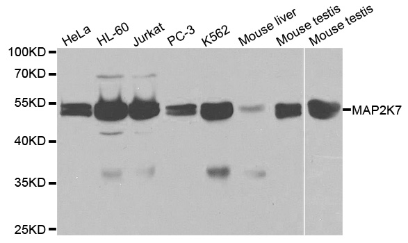 MAP2K7 / MEK7 Antibody - Western blot analysis of extracts of various cell lines, using MAP2K7 antibody.