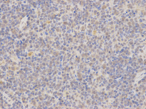 MAP2K7 / MEK7 Antibody - Immunohistochemistry of paraffin-embedded rat spleen using MAP2K7 antibody at dilution of 1:100 (400x lens).