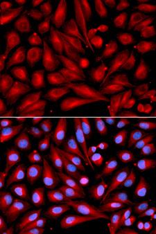 MAP2K7 / MEK7 Antibody - Immunofluorescence analysis of U2OS cell using MAP2K7 antibody. Blue: DAPI for nuclear staining.