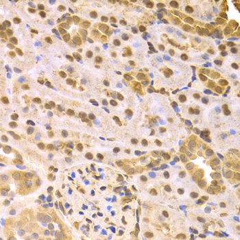 MAP2K7 / MEK7 Antibody - Immunohistochemistry of paraffin-embedded rat kidney tissue.