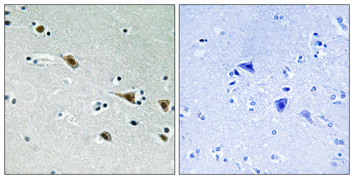 MAP2K7 / MEK7 Antibody - Immunohistochemistry analysis of paraffin-embedded human brain, using MAP2K7 (Phospho-Ser271) Antibody. The picture on the right is blocked with the phospho peptide.