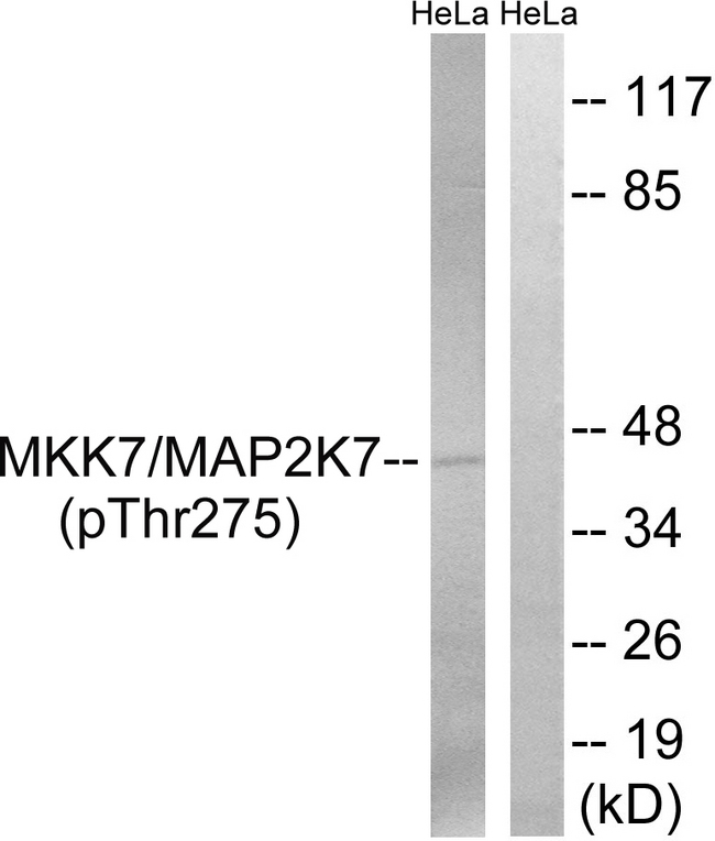 MAP2K7 / MEK7 Antibody - Western blot analysis of lysates from HeLa cells treated with calyculinA 50ng/ml 30', using MAP2K7 (Phospho-Thr275) Antibody. The lane on the right is blocked with the phospho peptide.