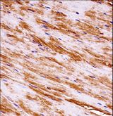 MAP3K1 / MEKK1 Antibody - Mouse Map3k1 Antibody immunohistochemistry of formalin-fixed and paraffin-embedded m.heart tissue followed by peroxidase-conjugated secondary antibody and DAB staining.