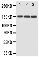 MAP3K1 / MEKK1 Antibody - WB of MAP3K1 / MEKK1 antibody. All lanes: Anti-MAP3K1 at 0.5ug/ml. Lane 1: Rat Heart Tissue Lysate at 40ug. Lane 2: JURKAT Whole Cell Lysate at 40ug. Lane 3: K562 Whole Cell Lysate at 40ug. Predicted bind size: 164KD. Observed bind size: 130KD.